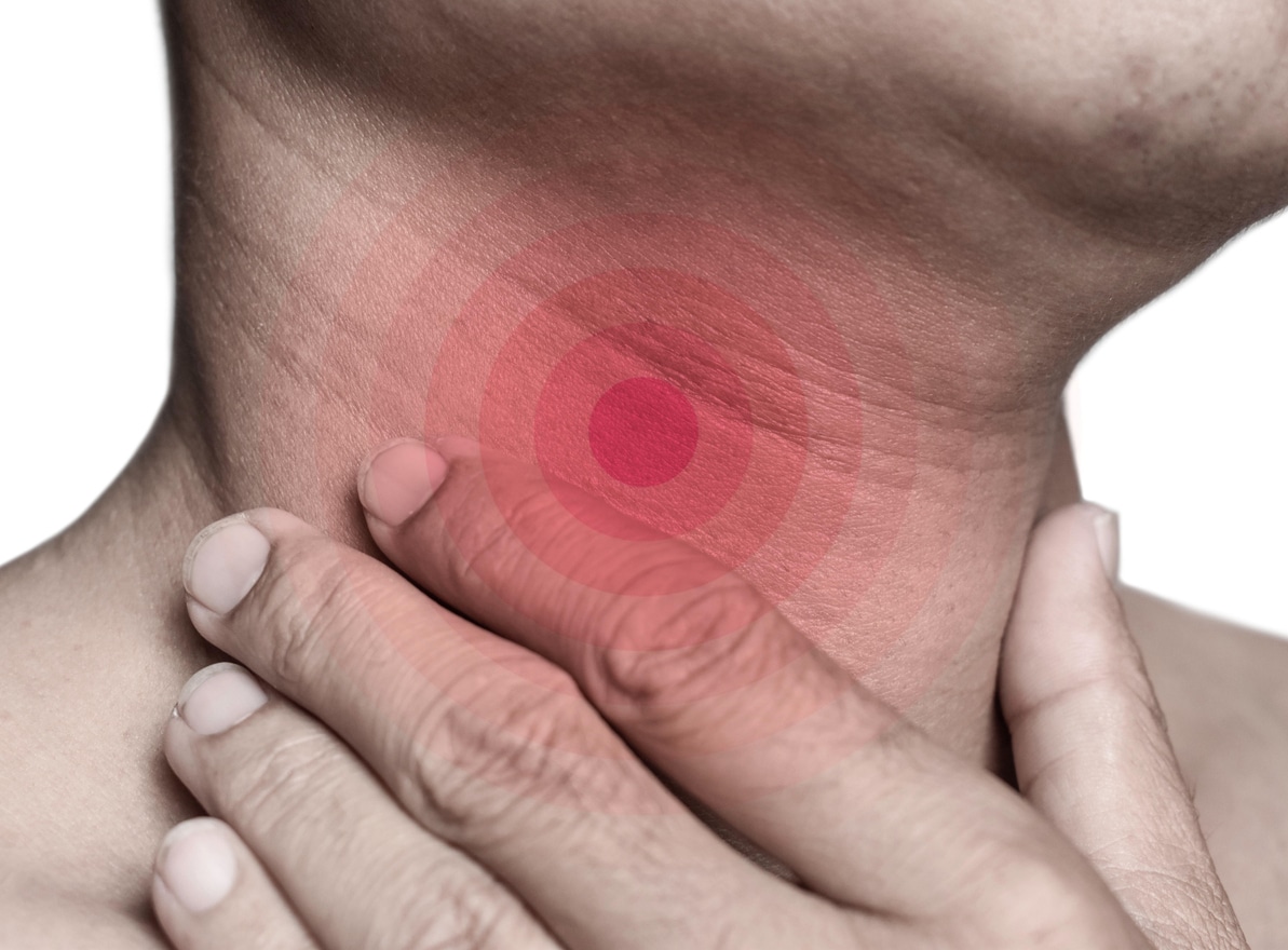 Red circles superimposed on a person's throat, indicating pain or sore throat.